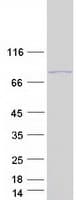 Human CCDC155 Protein (Recombinant Myc-DDK (Flag))