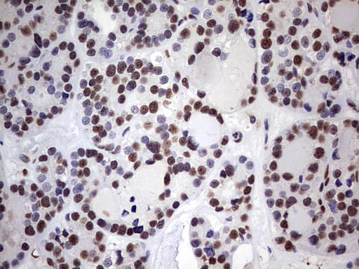 MYF5 / MYF 5 Antibody (clone OTI2G5)
