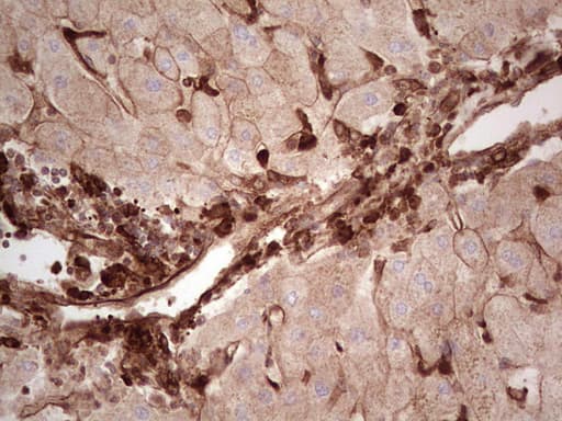 LGALS9 / Galectin 9 Antibody (clone OTI1D12)