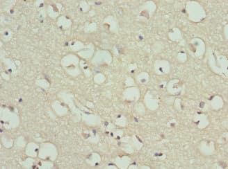 GPBB / PYGB Antibody