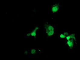 LSM1 Antibody (aa1-133, clone OTI9D7, Carrier-free)