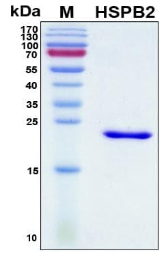 Human HSPB2 / HSP27 Protein (Recombinant His, N-Terminal)