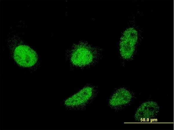 Monoclonal Mouse anti-Human CSDC2 Antibody (clone 2H8, IF, WB)