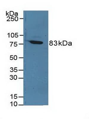 F13A1 / Factor XIIIa Antibody (aa140-377, Cy3)