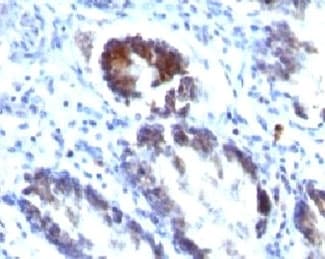 TAGLN / Transgelin / SM22 Antibody (clone TAGLN/247)