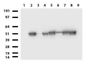 Vimentin Antibody (clone UMAB160, Carrier-free)