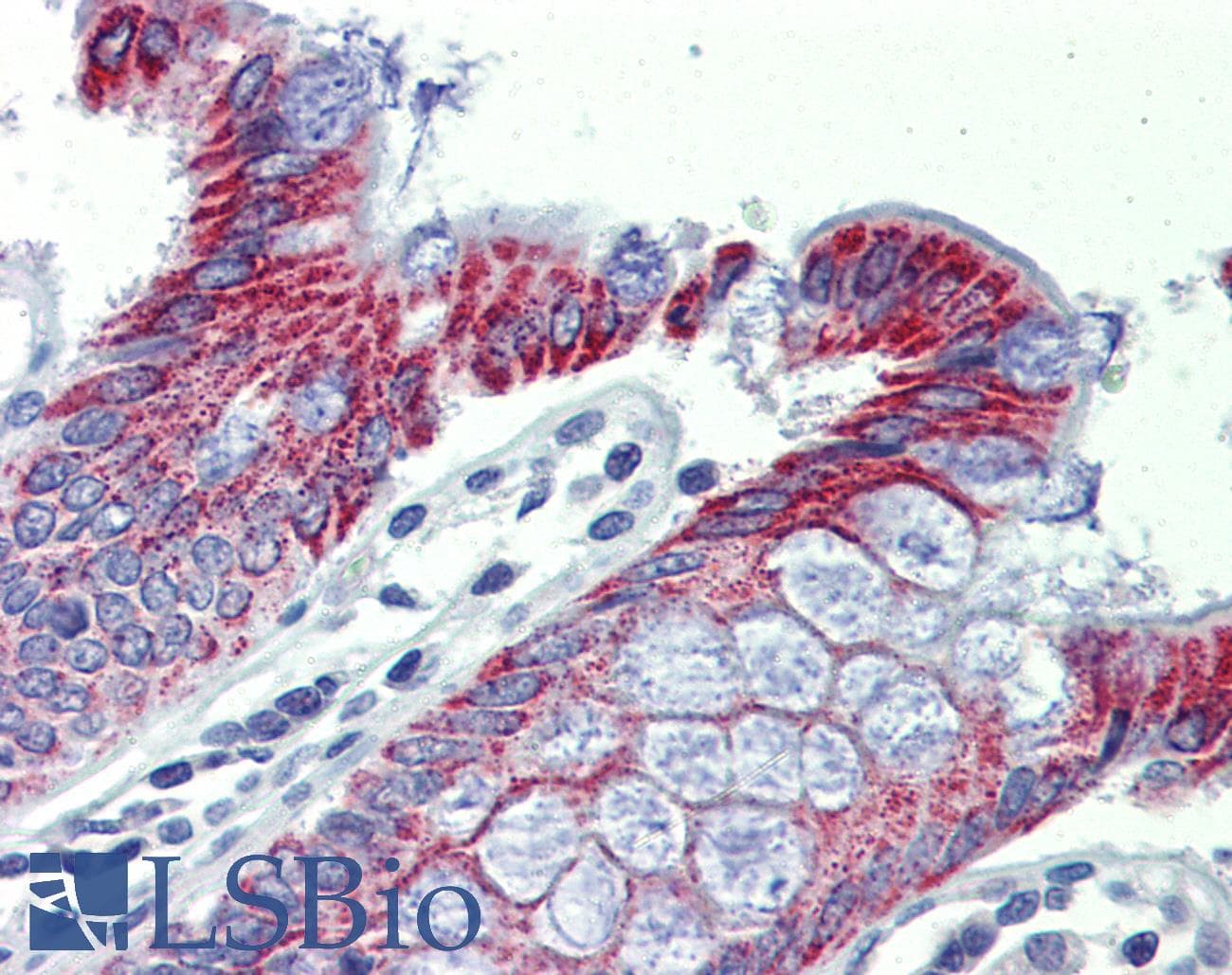 Polyclonal Rabbit anti-Human ACAA1 Antibody (aa36-85, IHC, WB)