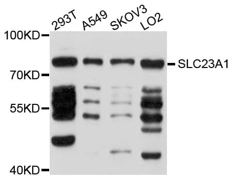 SLC23A1 / SVCT1 Antibody