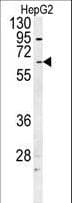 UGT1A / UGT1A1 Antibody (aa65-90)