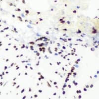 Polyclonal Rabbit anti-Human BHLHB2 / DEC1 Antibody (IHC, IF, WB)