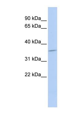 SULT1C4 / Sulfotransferase 1C4 Antibody (aa180-229)