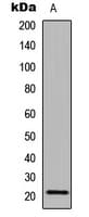 CALML6 Antibody (Internal)