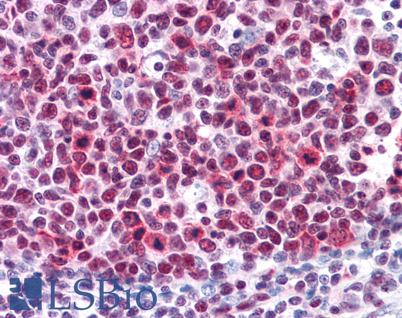 IHC-plus™ HMG1 / HMGB1 Antibody (clone 1B11)