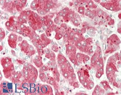 IHC-plus™ Polyclonal Rabbit anti-Human PRSS1 / Trypsin Antibody (aa81-107, IHC, WB)