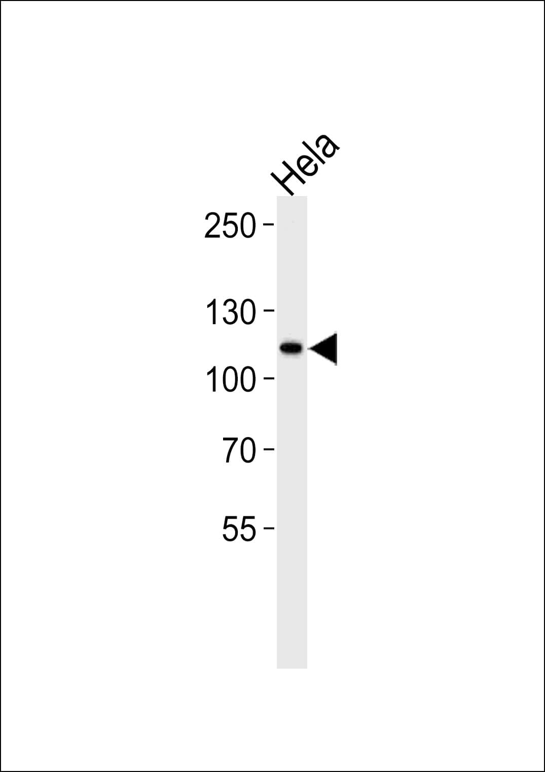 HK2 / Hexokinase 2 Antibody (aa91-121)