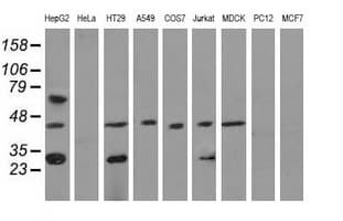QPRT Antibody (clone OTI4B3)