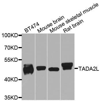 TADA2L / ADA2A Antibody