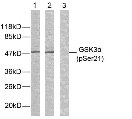 GSK3A / GSK3 Alpha Antibody (phospho-Ser21)