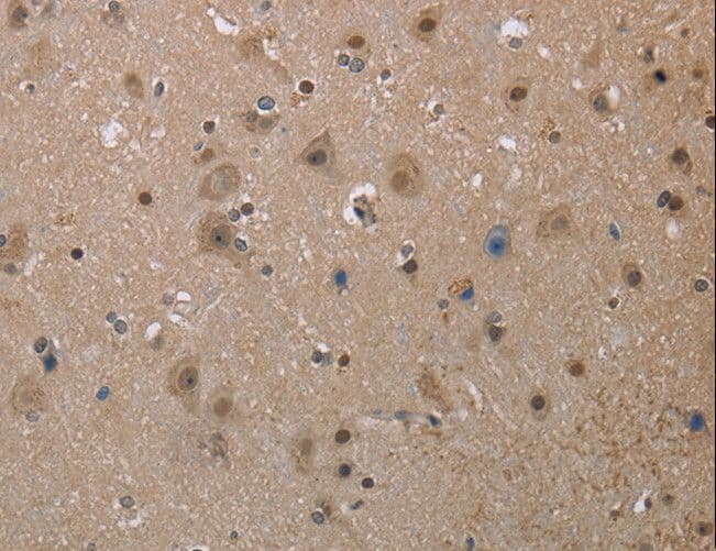 MGLL / Monoacylglycerol Lipase Antibody