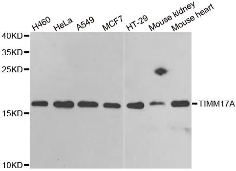 Polyclonal Rabbit anti-Human TIMM17A / TIM17 Antibody (IHC, IF, WB)