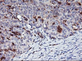 Monoclonal Mouse anti-Human VASP Antibody (clone OTI1F3, IHC, WB)