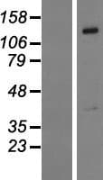 PTPN21 / PTPD1 Protein (Over-Expression Lysate Myc-DDK (Flag))