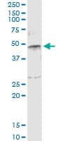 Monoclonal Mouse anti-Human SERPINE1 / PAI-1 Antibody (clone 3F2, WB)