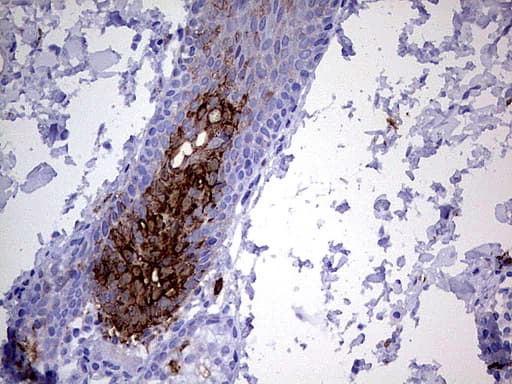 S100A9 / MRP14 Antibody (clone UMAB174, Carrier-free)
