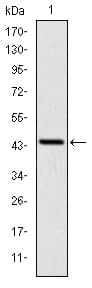 LIMS1 / PINCH Antibody (clone 5G7)