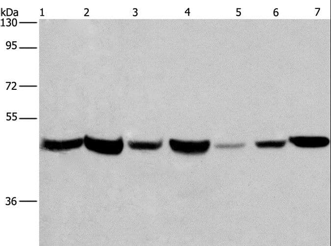 APMAP / C20orf3 Antibody