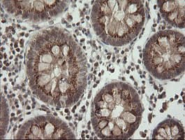 PIK3CG / PI3K Gamma Antibody (clone OTI1A9)