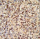p56lck / LCK Antibody (aa480-509)