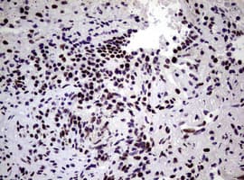 NBN / Nibrin Antibody (clone OTI6E11)