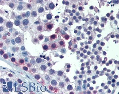 IHC-plus™ LIMK1 / LIMK Antibody (aa597-647)