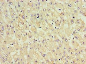 Polyclonal Rabbit anti-Human KIF6 Antibody (aa565-814, IHC)