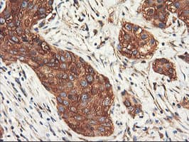 PFKP Antibody (clone OTI1F2)