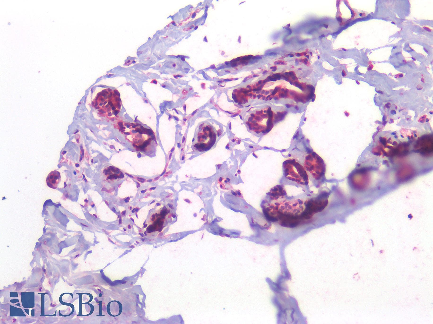 IHC-plus™ CX3CL1 / Fractalkine Antibody