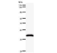 DHX9 Antibody (clone 2274D5a)