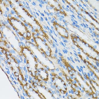 CTNNA1 / Catenin Alpha-1 Antibody