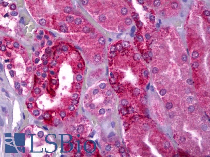 IHC-plus™ Polyclonal Rabbit anti-Human NAPE-PLD Antibody (IHC, WB)