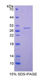 Mouse CENPH / CENP-H Protein (Recombinant His-T7)