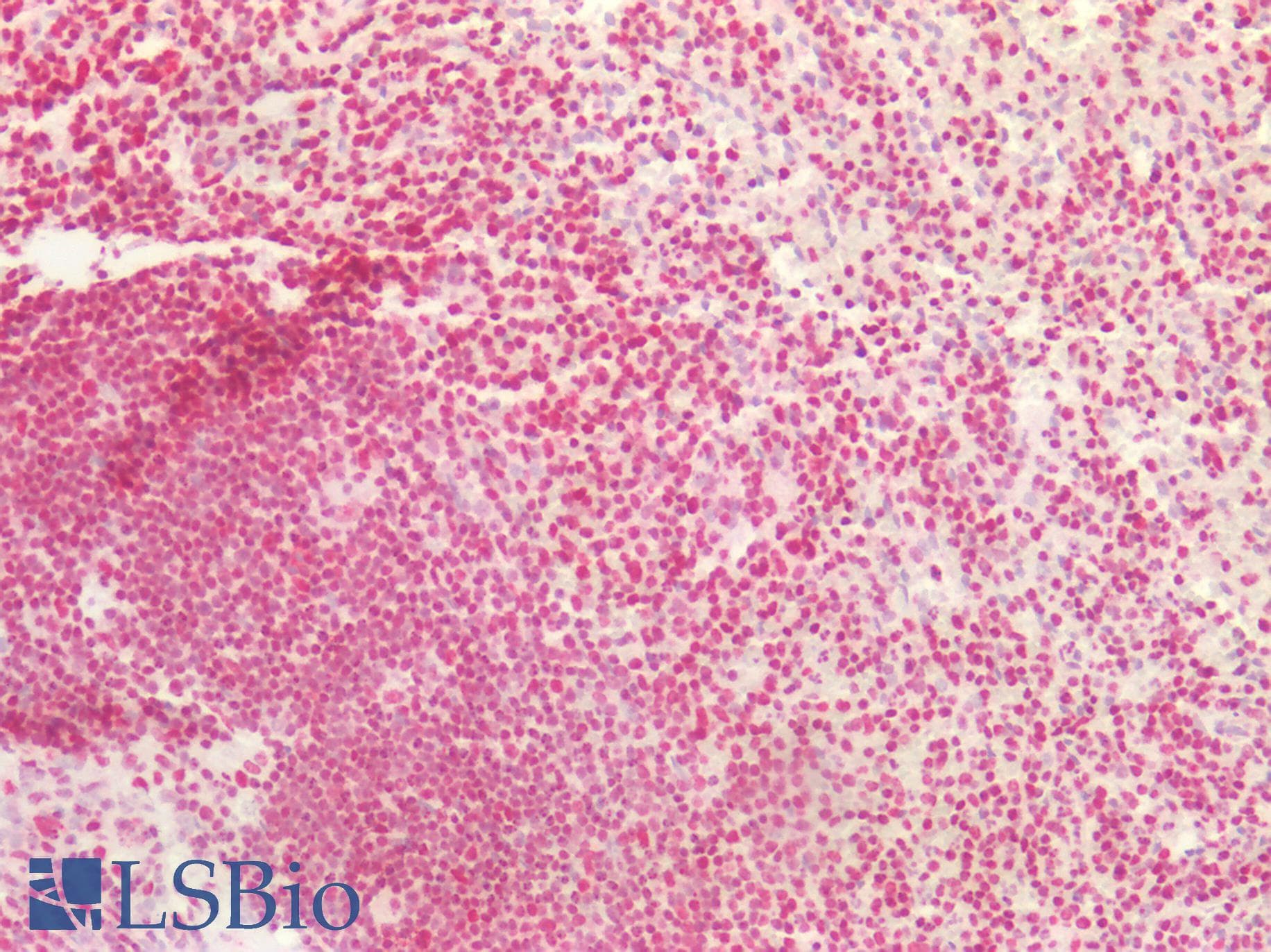 PathPlus™ HNRNPK / hnRNP K Antibody (aa200-250)