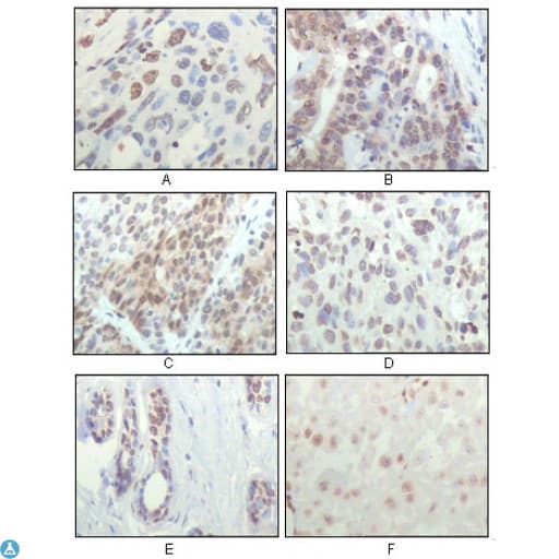 RPS6KA1 / RSK1 Antibody