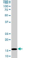 IHC-plus™ HIST1H3D Antibody (clone 1D8)