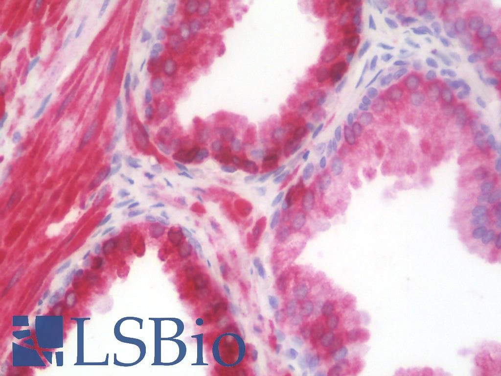 PathPlus™ AGR2 Antibody