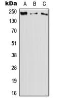 DOCK11 Antibody (Internal)