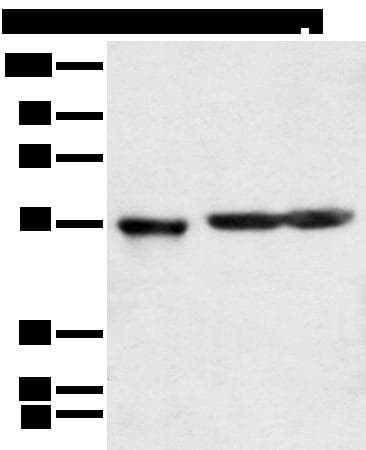 Polyclonal Rabbit anti-Human KCTD16 Antibody (IHC, WB)
