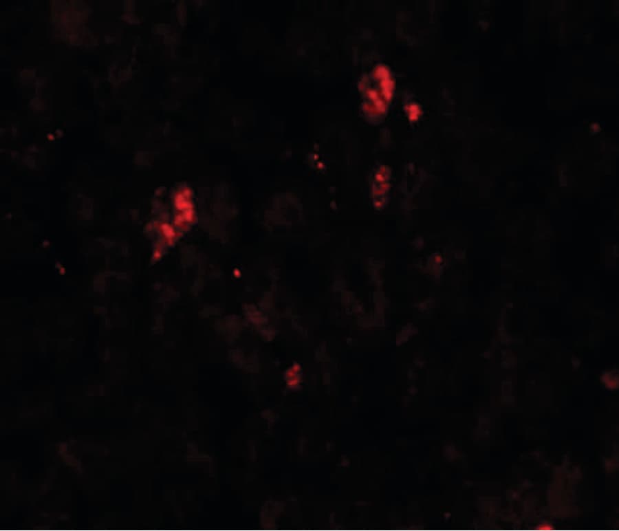 Polyclonal Rabbit anti-Human SUMO2 + SUMO3 Antibody (IHC, IF, WB)