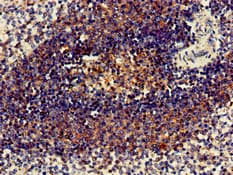 Polyclonal Rabbit anti-Human C1orf177 Antibody (IHC, WB)