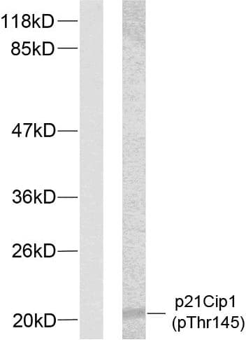 Polyclonal Rabbit anti-Human CDKN1A / WAF1 / p21 Antibody (phospho-Thr145, IHC, WB)